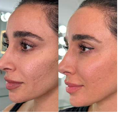 Contour and skin tone — before and after